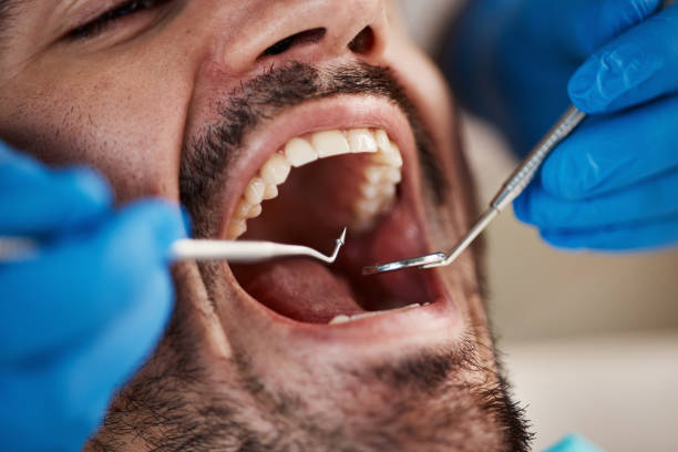 Best Broken or Cracked Tooth Emergency Dentist in Bonsall, CA
